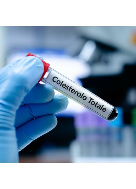 Misurazione colesterolo totale